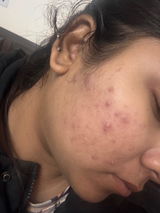 Anonymous review photo