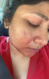 Anonymous review photo
