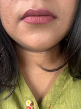Anonymous review photo