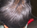 Anonymous review photo