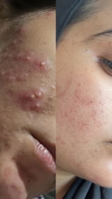 Noor review photo