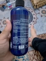 Anonymous review photo