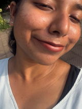 Anonymous review photo