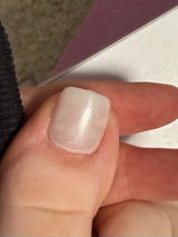 Anonim review photo