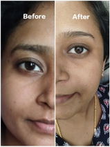 Anu review photo