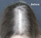 Hair Fall Serum Organic (100% Ayush Ministry Certified) - For Hair Fall Control, Reduced Hair Loss & Baldness (Both Men & Women)