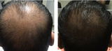 Harsh Kumar review photo