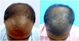 Vikas Kumar review photo