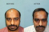 Sunil verma review photo