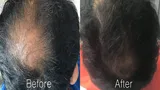Rakesh chauhan review photo