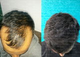 Aditya Gandhi review photo
