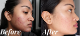 Narmita Singh review photo