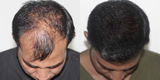 Rajesh kashyap review photo