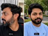 Anurag Yadav review photo