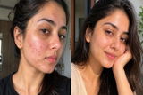 Dimple Verma review photo
