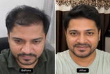 Milan Kapur review photo