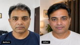 Milan Kapur review photo