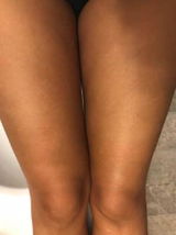 Rosa X review photo