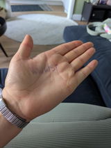 Anonymous review photo