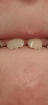 Agnes review photo