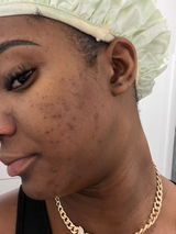 Myriam Adeus review photo