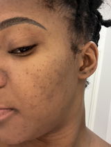 Myriam Adeus review photo