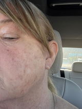 Anonymous review photo