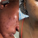 Anonyme review photo