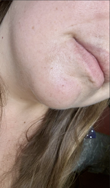 JustONEface Day & Night Patches