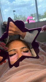 Anonymous review photo