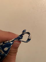 Anonymous review photo