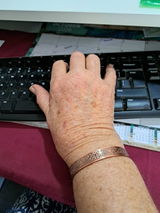Ann review photo