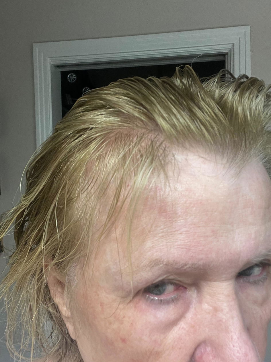 ghk-cu reddit hair peptides bpc 157 Before and After: Dosage, Benefits & How It Works for Skin and BPC-157 copper peptide hair serum reddit