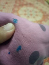 Anonymous review photo
