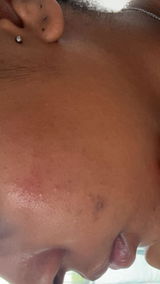 Anonyme review photo