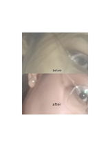 Anonymous review photo