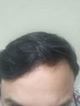 Anonymous review photo