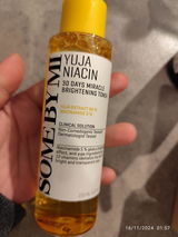 Senem review photo