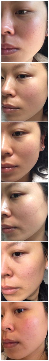 yunyi g. review photo