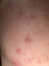 Anonymous review photo