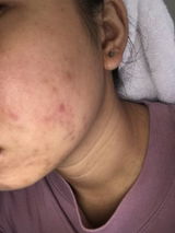 Manilyn R. review photo