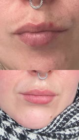 Alexa review photo
