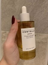 Anonym review photo