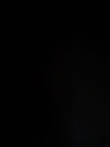 Anonym review photo