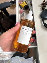 Anonym review photo