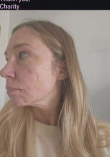 Charity review photo