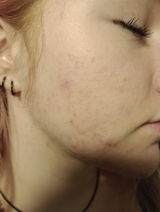 Becci review photo