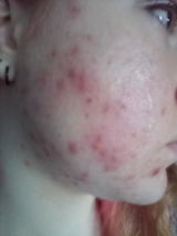 Becci review photo