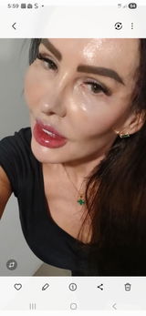Anonymous review photo