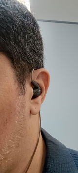 Anônimo review photo